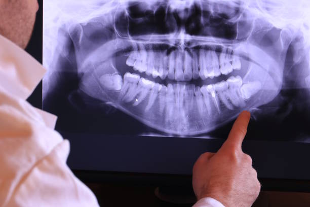 Best Same-Day Emergency Dentist in Lewisburg, KY