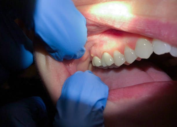 Best Same-Day Emergency Dentist in Lewisburg, KY